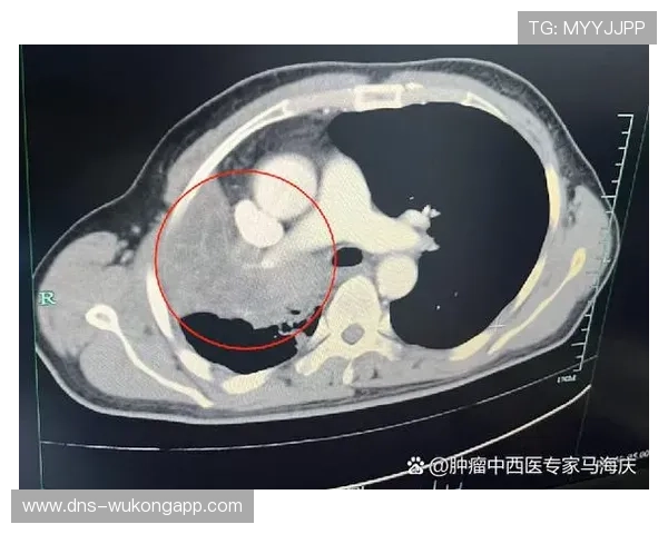 VAR介入标准详解：哪些情况必须暂停比赛复查判罚？